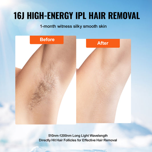 VEVOR IPL Hair Removal, Permanent Hair Removal With Ice Cooling System For Women Men, Auto Manual Modes & 5 Levels, Painless At-Home Hair Removal Device For Legs, Arms, Armpits, Bikini Line